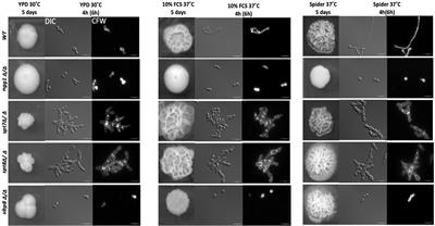 SAGA Complex Subunits in Candida albicans Differentially Regulate Filamentation, Invasiveness, and Biofilm Formation